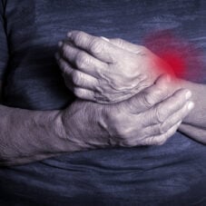 prevent arthritis