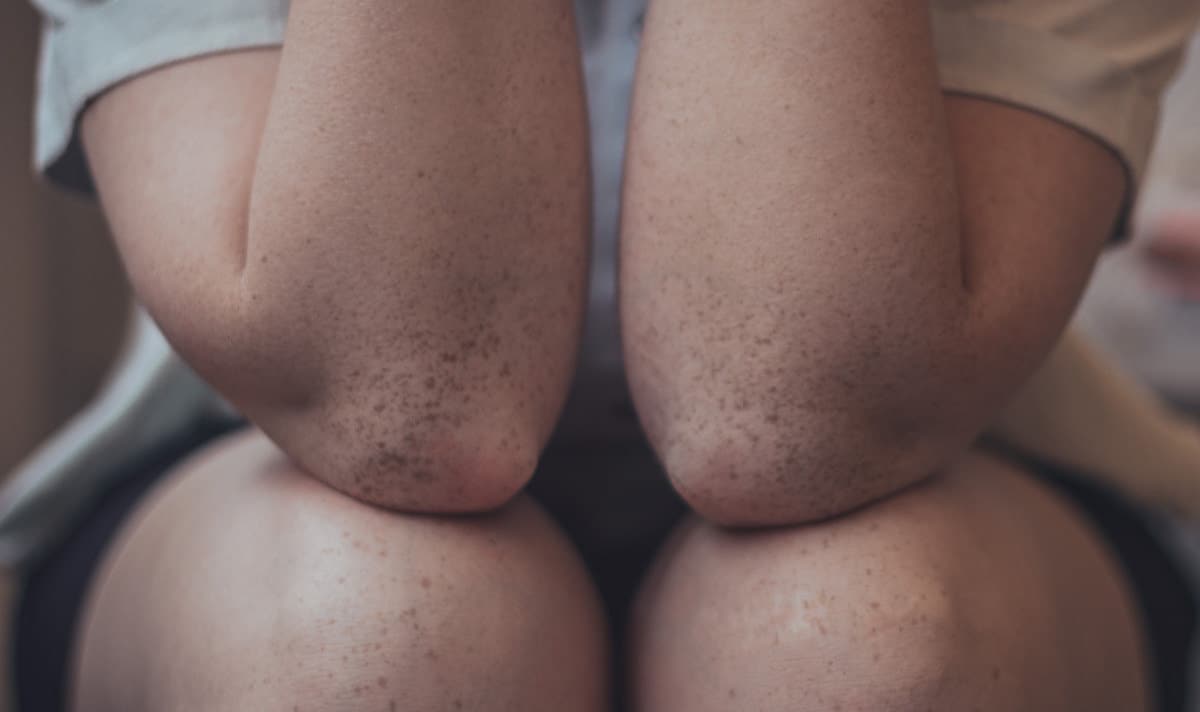 Glucosamine is one of the most frequently used joint supplements for knee pain