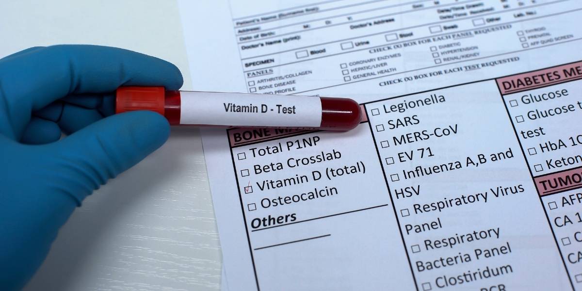 Vitamin D test