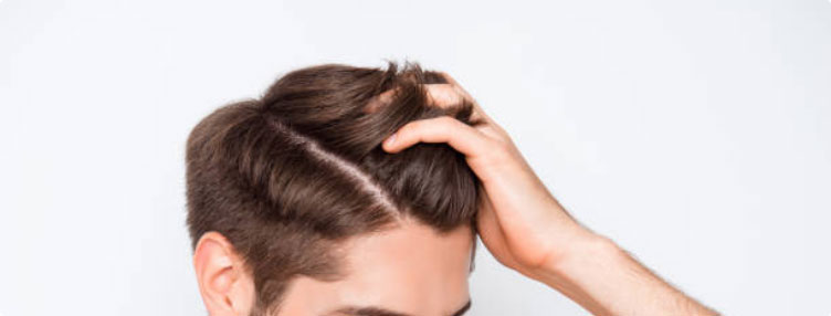 Picture of a guy holding his hair