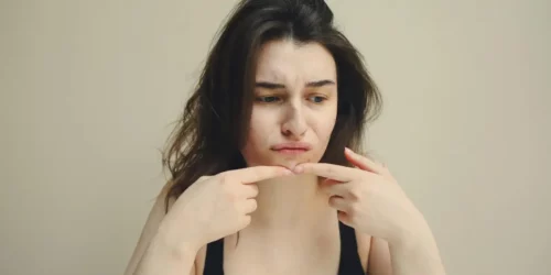 featured image for blog post on probiotics for acne